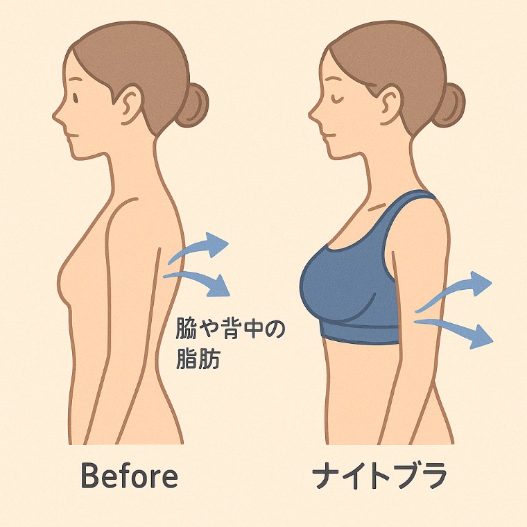 脂肪をナイトブラで寄せ集めているイラスト